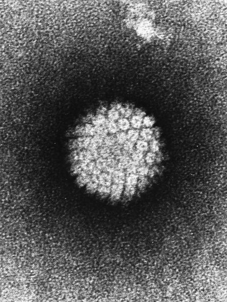 Human Papiloma Virus